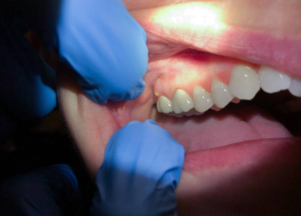 Best Emergency Dental Surgery in Pulaski, VA