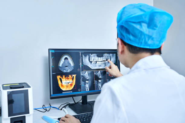 Best Emergency Tooth Extraction in Pulaski, VA
